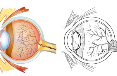 Greffe de Cornée : Une Lumière de Retour pour les Maladies Oculaires